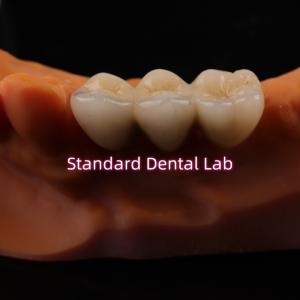 Quality Digital CAD CAM Dental Lab Crowns Translucent Layered Zirconia Crown wholesale