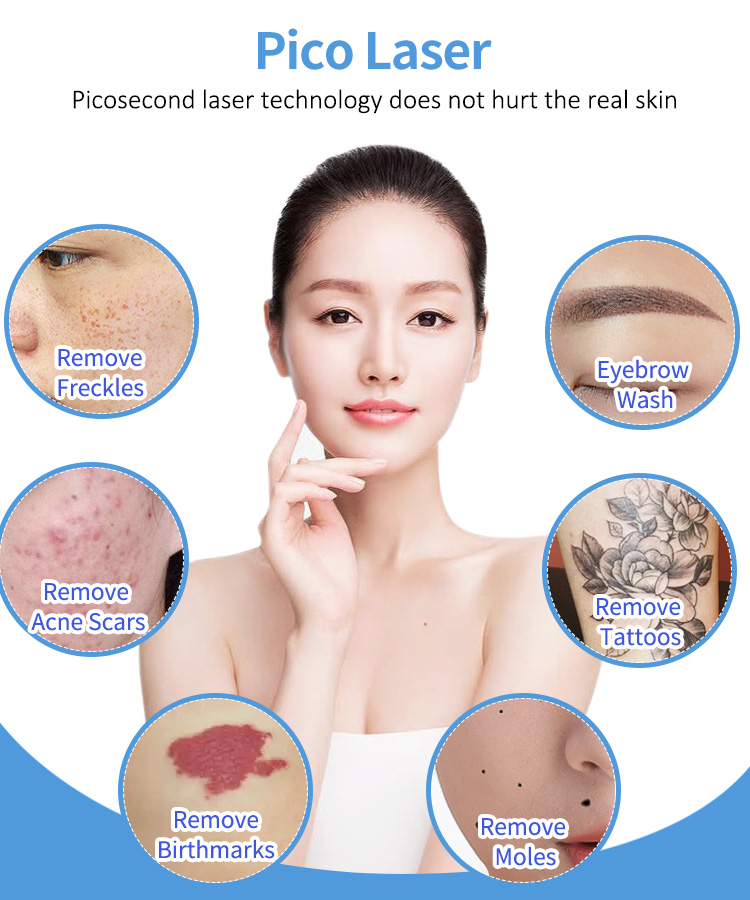2 In 1 ND Yag Laser Tattoo Removal Machine 755nm 532nm 1064nm Diode