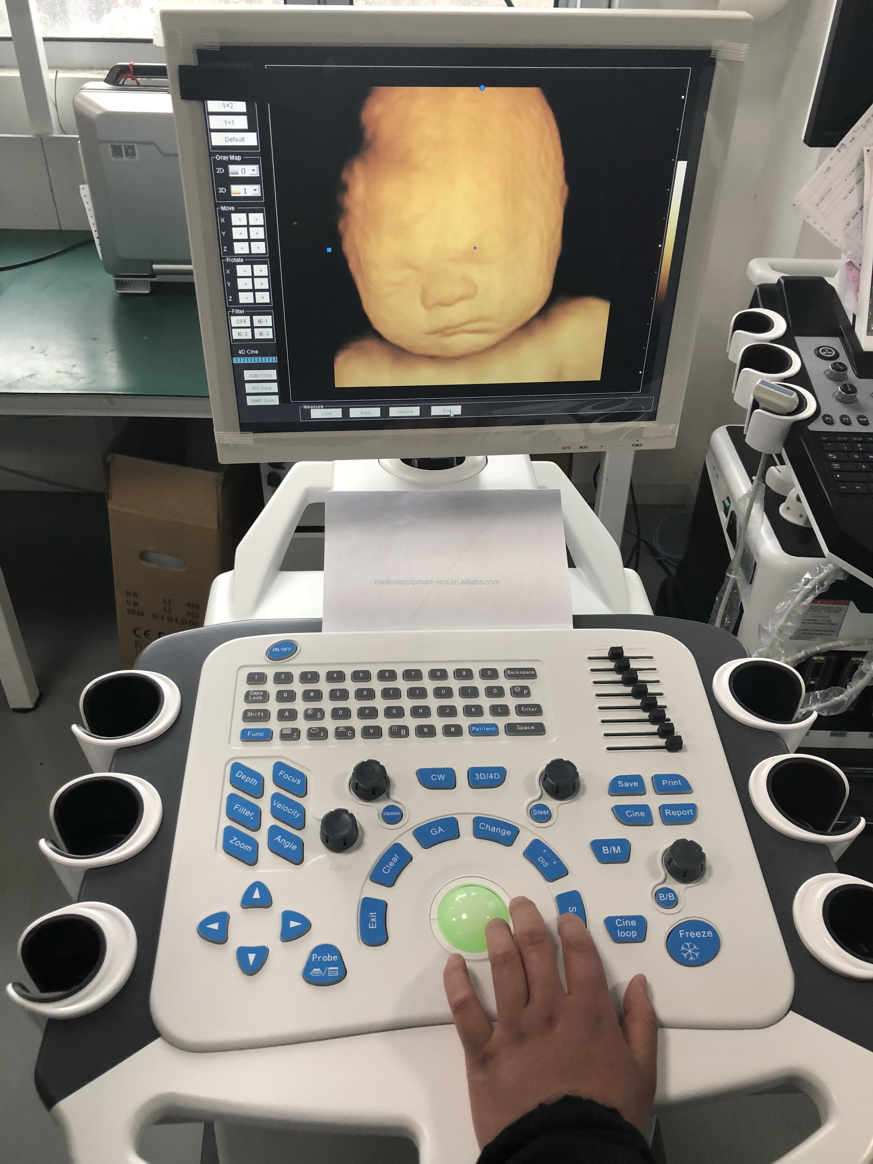 4D Color Doppler Ultrasound Machine Obstetrics And Gynecology Equipment Hospital