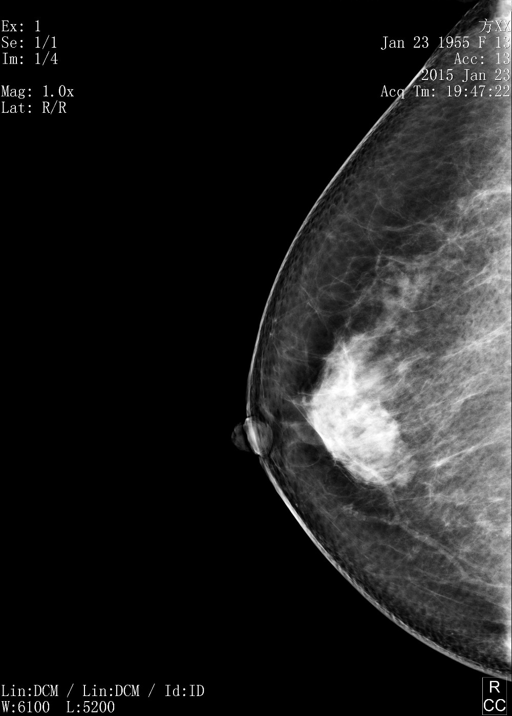Full Digital Mammography System with Panel Detector for Sales