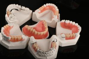 Quality Hypoallergenic Acrylic Dental Removables Artificial Teeth Removable Partial Denture wholesale