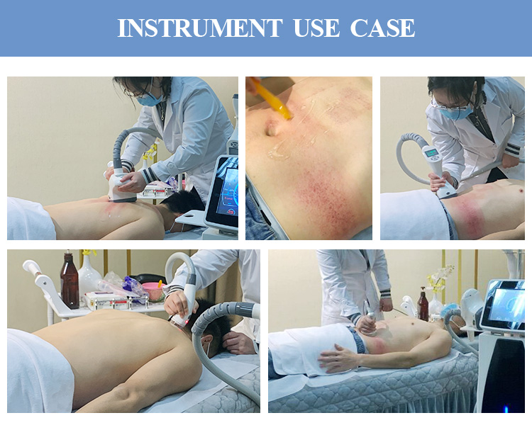 Cellulite Vacuum Roller Massage Machine 6 In 1 Cavitation Machine 80k Radio Frequency