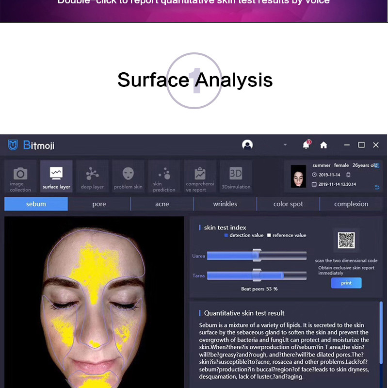 User Friendly Usb Computer Face Skin Analyzer