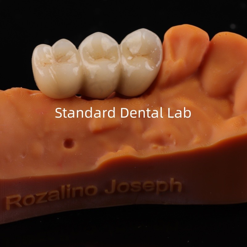 Digital CAD CAM Dental Lab Crowns Translucent Layered Zirconia Crown