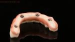 High Quality Dental zirconia crown and All On Four Six Implant Full Arch / China