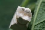 Fixed Prosthetics Permanent Solution EMAX Dental Crown