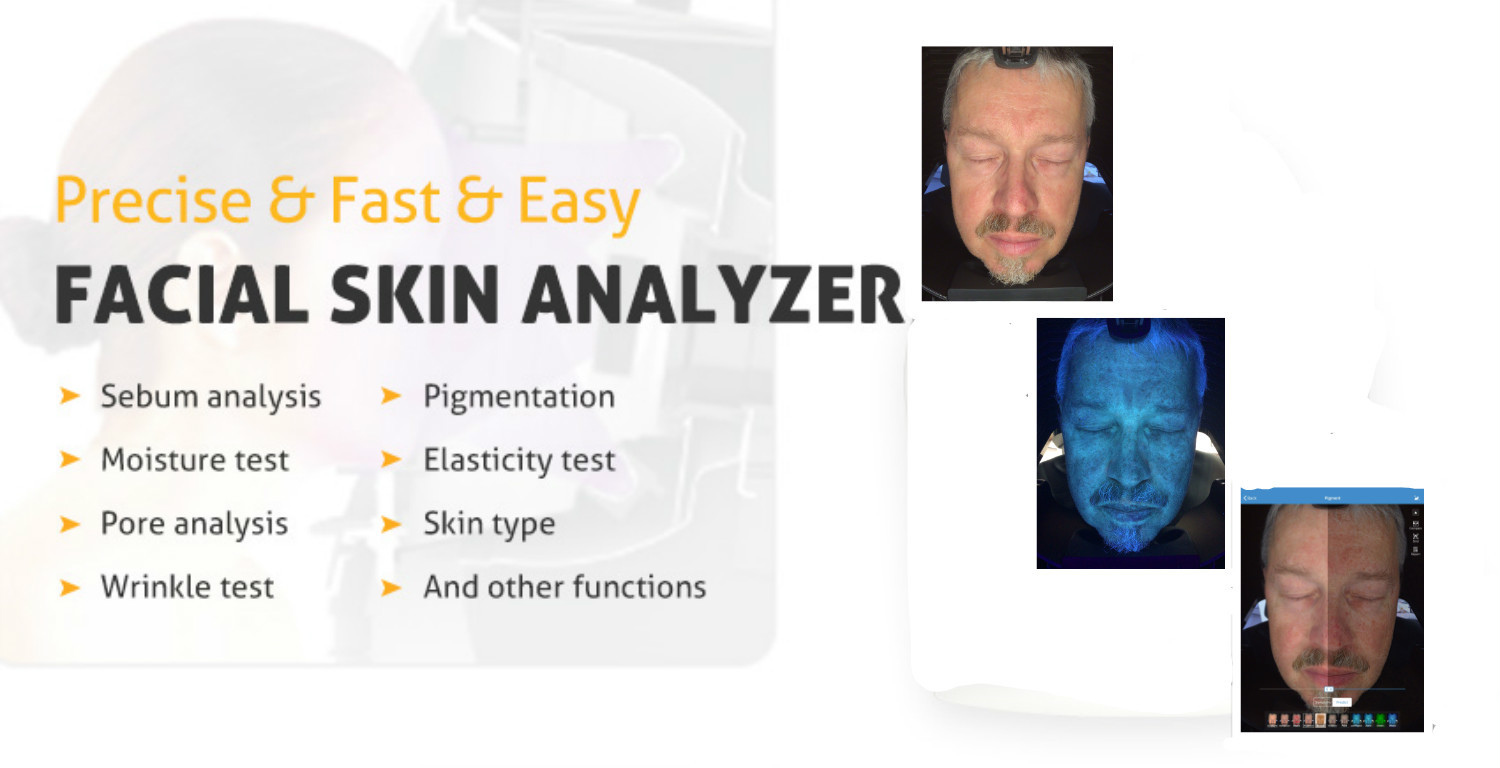 Intelligent Uv Light Facial Scanner Skin Analyzer 20 Seconds Speed