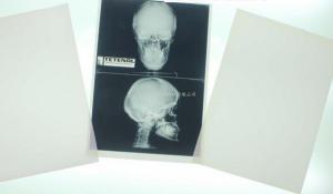 Quality 11 x 14 Laser Medical Diagnostic Imaging For Konida Laser Printer wholesale