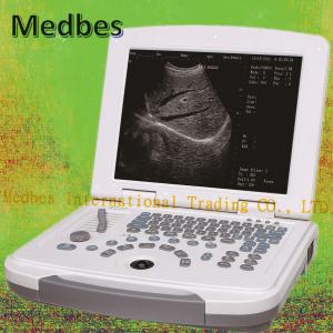 Quality Professional Ultrasound Imaging System 15 Inch LED Laptop Hospital Machine wholesale