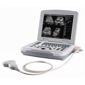Quality B/W laptop ultrasound machine wholesale