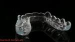 Night Dental Mouth Guard Occlusal Splint Ekodent Good Fit High Esthetics /