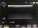 Hitachi EUP-L65 Linear Ultrasound Transducer/Small Parts, MSK, Venous