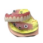 Implant Abutment Zirconia Dental Crown Natural All On Four Dentures