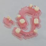 Flexibility Meets Invisibility Dental Flexible Resin for Full Dentures