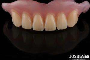 Quality High Stealth Flexible Removable Denture Finished Comfortable Fit Dental Lab wholesale