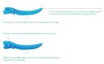 Dentistry Dental Sectional Matrix System Dental Matrices And Wedges Plastic