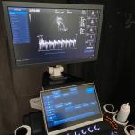 Fetal Doppler Medical Ultrasound Machine Trolley 3D 4D 5D