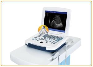 Quality High Definition Digital Ultrasound Machine , Advanced Real Time Ultrasound Machine wholesale
