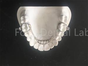 Quality Customizable Expanding Retainer Palatal Expander Retainer Easy Maintenance wholesale