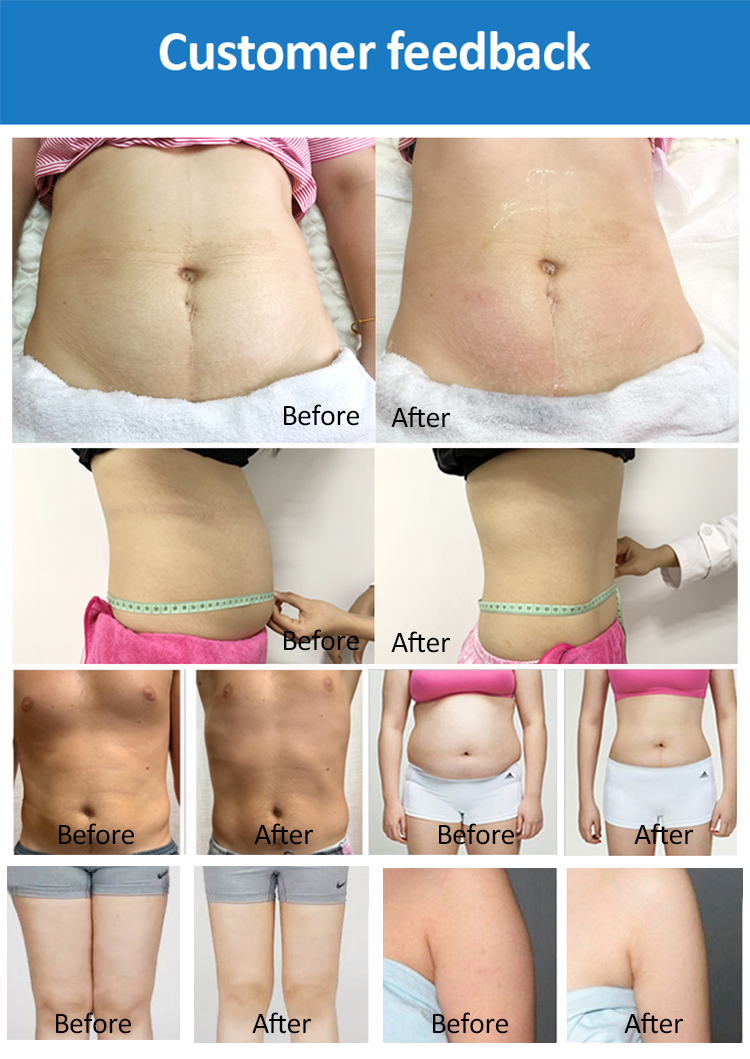 635nm Wavelength Beauty Apparatus Laser Slimming Cellulite Reduction Machine