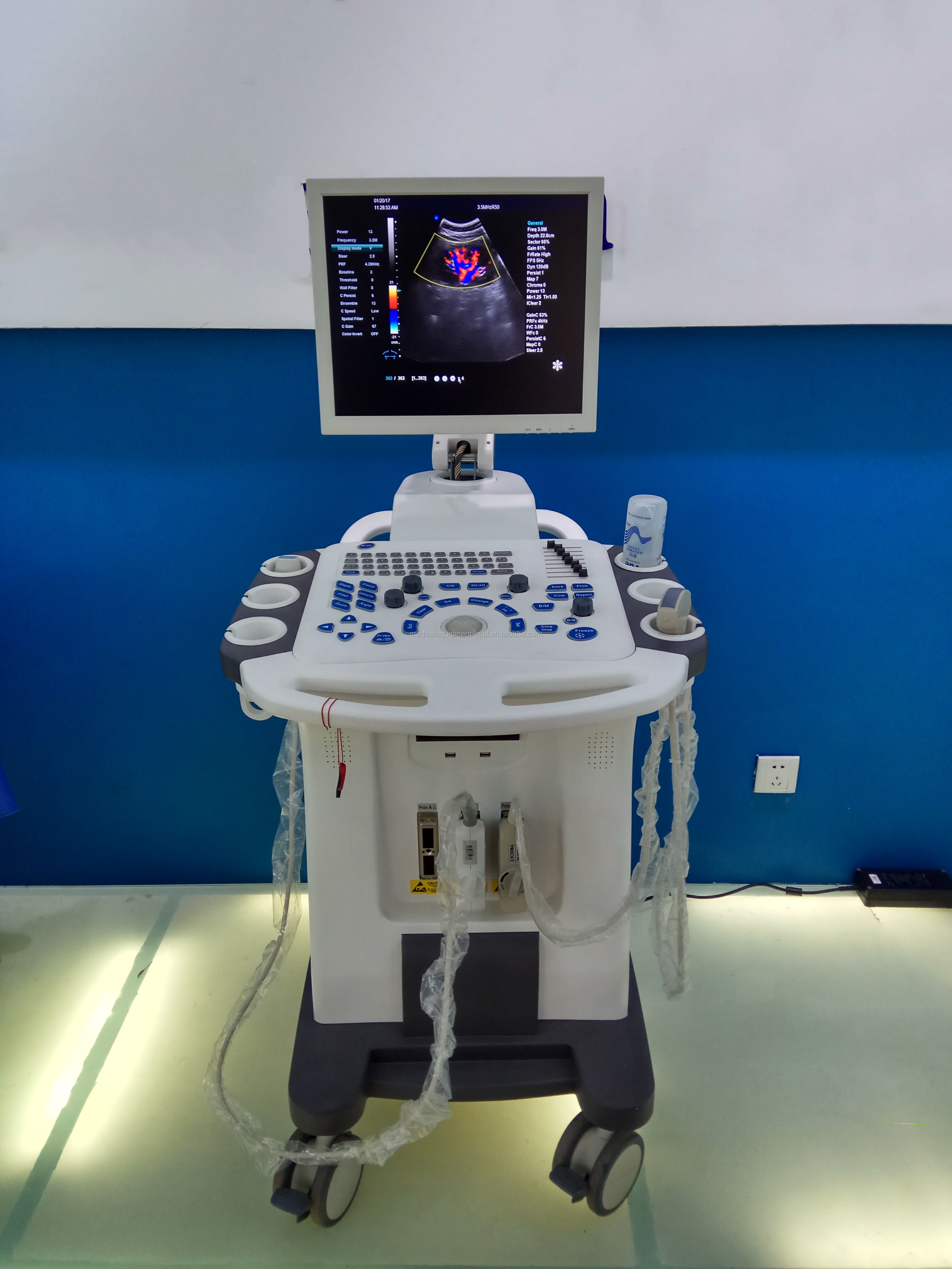4D Color Doppler Ultrasound Machine Obstetrics And Gynecology Equipment Hospital