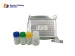 96 Wells 48 Wells Human CRH ELISA Kit Strong Sensitivity
