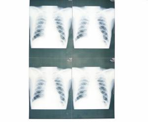 Quality 20cm x 25cm Medical Diagnostic Imaging , Laser Printer Film X Ray Paper wholesale