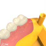 Dental 3d Printing High Strength Mobile Base Biocompatible UV Resin