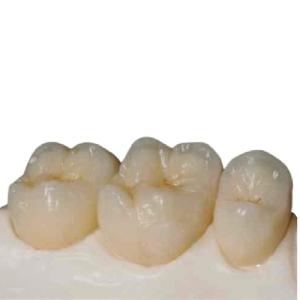 Quality Computer-aided Manufactured Customized Zirconia Dental Crown wholesale