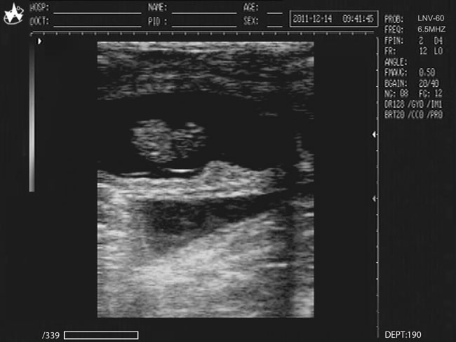 Medical Veterinary Equipment 10.4 Inches Screen Portable Ultrasound Scanner