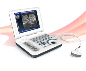 China Diagnostic Laptop Ultrasound Machine Digital Ultrasound Scanner Durable on sale