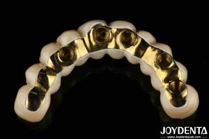 Quality Custom Made Ti-Bar Zirconia Hybrid Bridge Precision Fit Dental Prosthesis wholesale