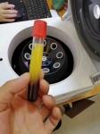 TD4D 5ml 10ml 15ml 20ml Low Speed PRP Centrifuge 4000rpm