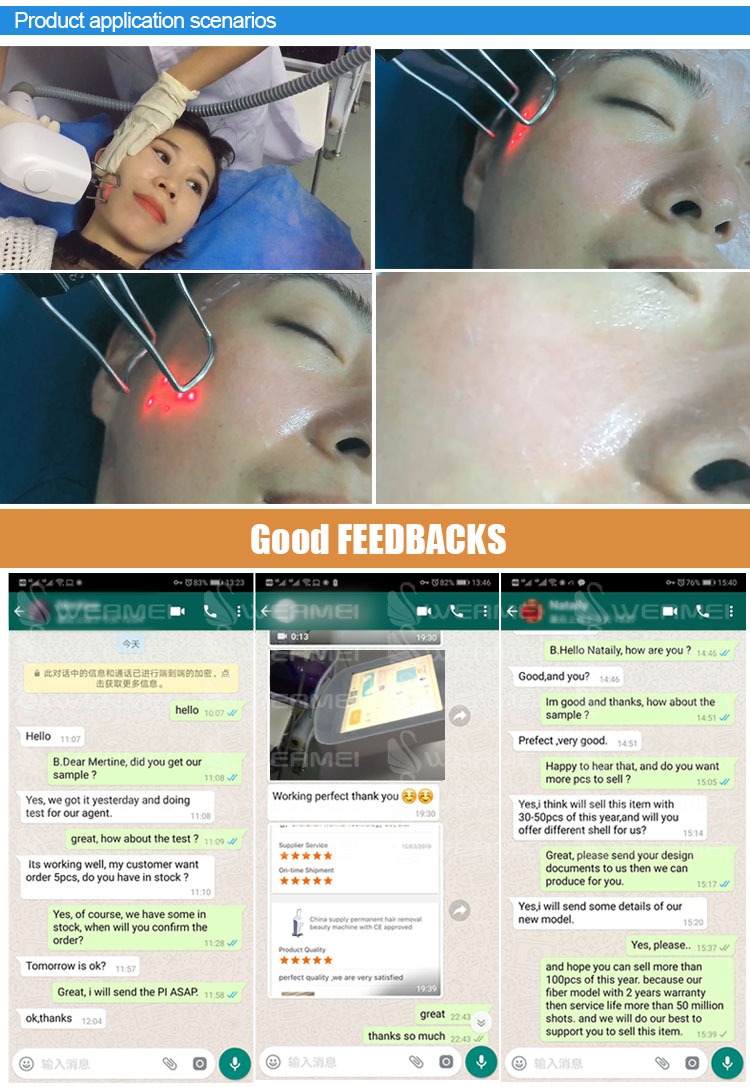 Safe 1550 Er Yag Laser Lifotronic Fractional Erbium Glass Laser for Skin Resurfacing