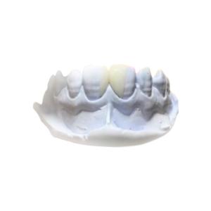Quality Efficient Resin Removable PFM Dental Crown Health Materials wholesale