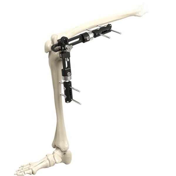 High Quality Orthopedic Surgical Instruments Knee Joint External Fixator