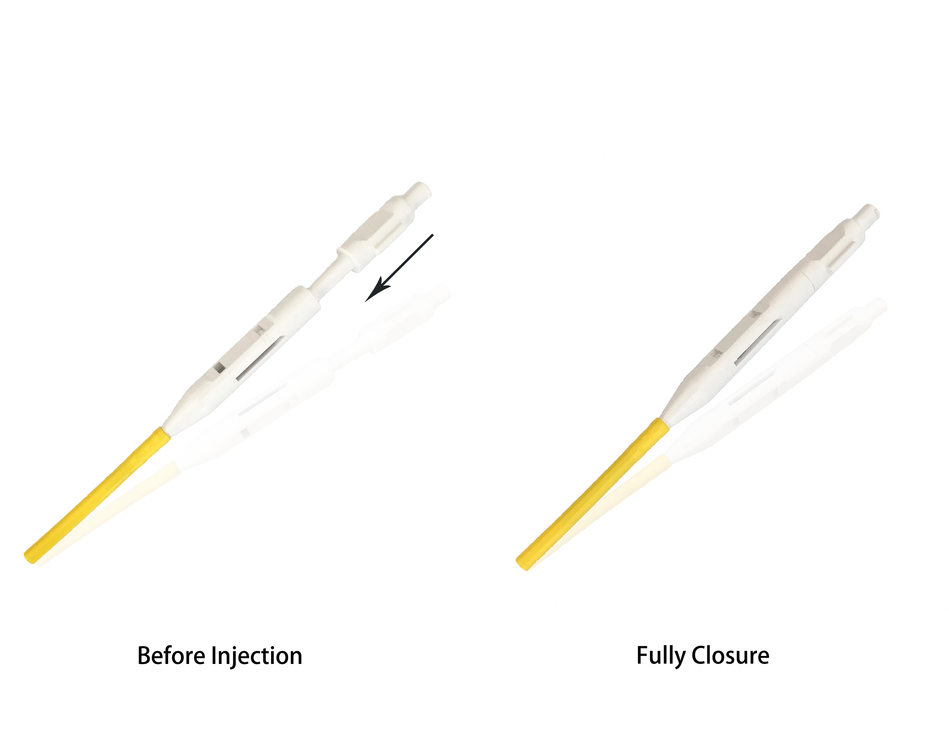 23G Endoscopic Injection Needle