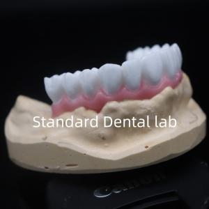 Quality High Esthetics White Dental Crown Diagnostic Wax Up Customized China Dental Lab wholesale