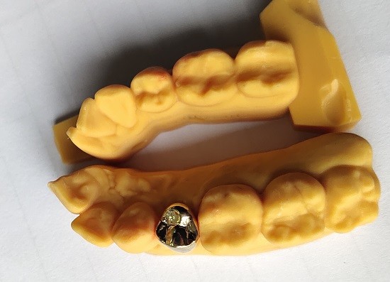 High Noble Gold Full Metal Dental Crown