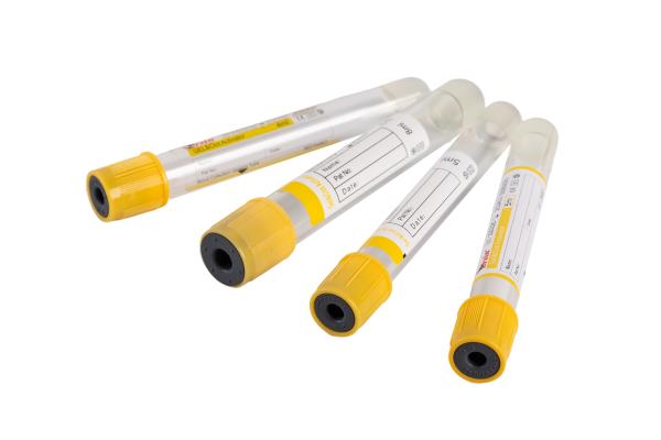 5ml 6ml 7ml 8ml Gel And Clot Activator Yellow Serum Separator Clot Activator