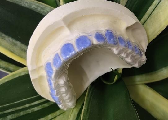 Cheap ISO13485 Teeth Whitening Bleach Guard For Smoke Stains for sale