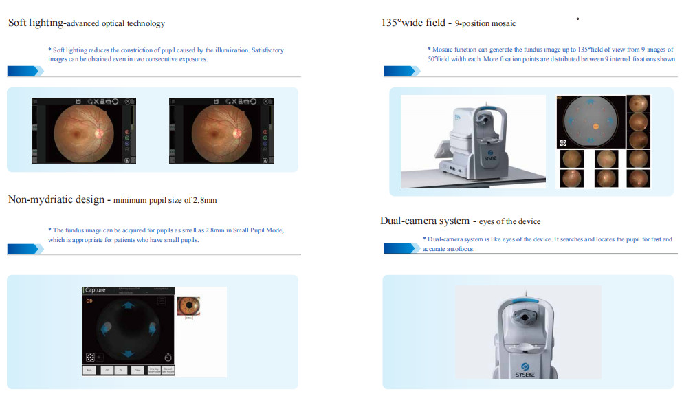 Automatic Retinal Imaging Fundus Camera 135° Wide Field 17mm Working Distance