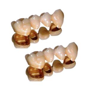 Quality Palladium Porcelain Dental Crown Excellent Ductility Corrosion Resistant wholesale