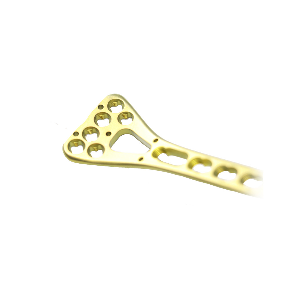 Orthopedic Implants Trauma Plate Distal Radius Multi-Axial Locking Plate