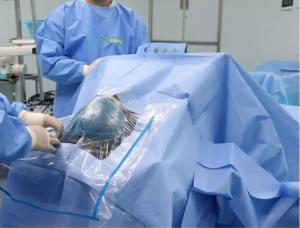 Quality Customized Disposable Surgical Neuro Cranial Drape Pack Kits For Hospital wholesale