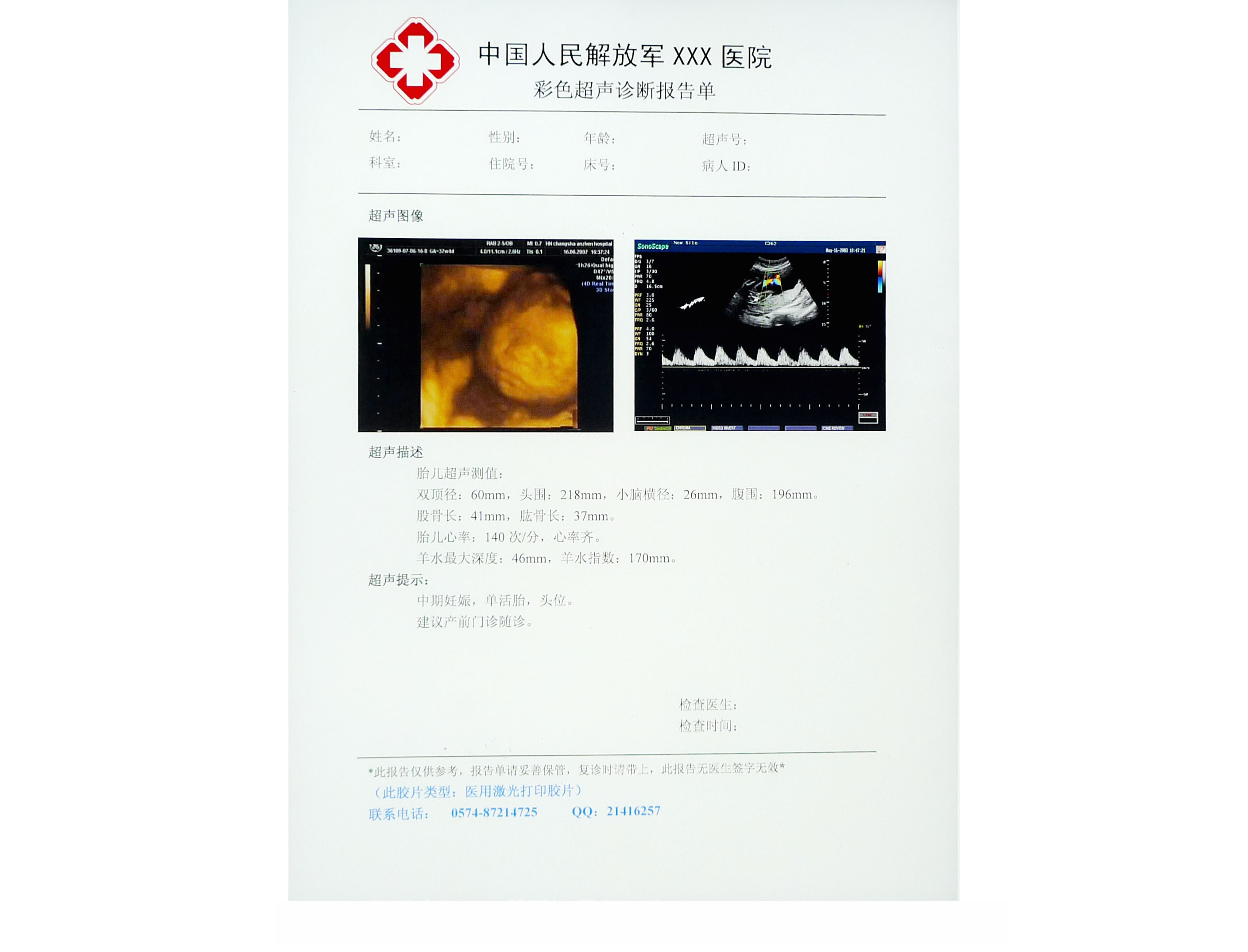 Hosipital PET Film Medical X Ray Paper Waterproof 8 ×10 Inch CT Film White
