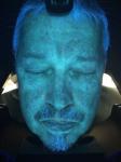Smart Skin Analyzer Machine Portable Facial 3d Skin Wrinkle Analysis