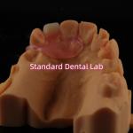 Dental TCS Valplast Flexible Partial Dentures Nesbit Valplast Finish China