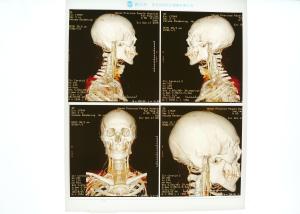 Quality Scratch-resistant X Ray Medical Imaging For Konida Laser Printer wholesale