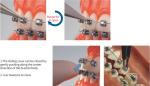 20pcs Roth MBT Brackets Dental Orthodontic Braces